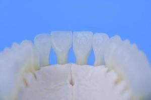 mandíbula humana inferior com modelo de anatomia dos dentes foto