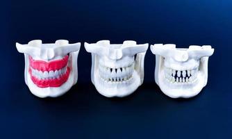 maxilares humanos com modelos de anatomia de dentes e gengivas foto