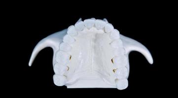 maxilar humano superior com dentes isolados em fundo preto foto