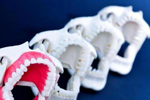 modelos de dentes ortodônticos de dentista foto