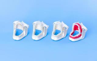 modelos de dentes ortodônticos de dentista foto