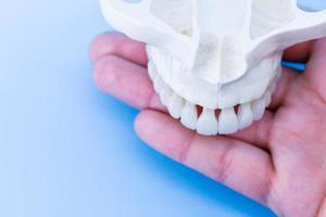 mão humana segurando um maxilar superior com dentes foto