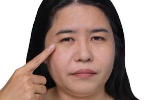 mulher asiática mostrando a flacidez da pele adiposa flácida, manchas flácidas e escuras no rosto, celulite sob os olhos, linhas da testa no rosto, problema enrugado e envelhecido de mulher de meia-idade. foto