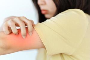 a mão de uma mulher está coçando o braço devido a uma reação alérgica ou uma doença de pele. foto
