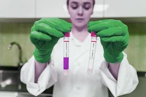 pesquisador médico ou científico feminino tem nas mãos tubos de ensaio foto