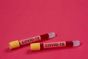 tubo de vácuo com sangue e a palavra covid-19 na etiqueta de identificação. foto