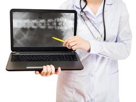 pontos de enfermeira no laptop do computador com coluna vertebral foto