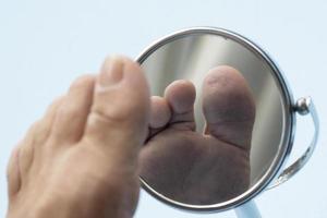 pessoa olhando a sola do pé no espelho, para verificar se não há pé diabético, como possíveis feridas foto