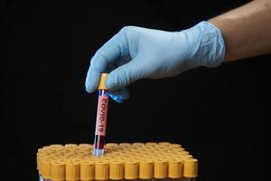 profissional de saúde segurando tubo de amostra de sangue foto
