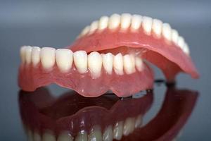 modelo de dentes para dentistas para explicar várias doenças ou problemas dentários. fundo cinza foto