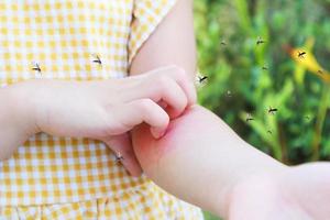 menina tem alergia de erupção cutânea e coceira no braço por picada de mosquito foto