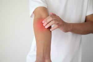 homem coçando e coçando no braço de dermatite eczema de pele seca com coceira foto