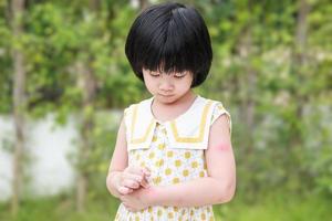 menina tem alergia de erupção cutânea comichão e coçando no braço foto