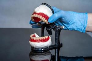 prótese dentária nas mãos do médico close-up. dentista segurando a ponte dental cerâmica. vista frontal da prótese total. foto conceitual de odontologia. prótese dentária.