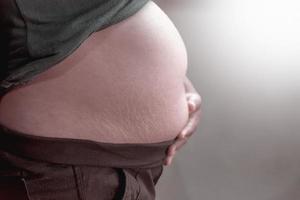 barriga gorda padrão de barriga listrada mulher ou cicatriz abdominal marcada pele padrão de grávida tem um filho. foto