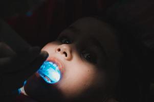 luz ultravioleta na odontologia, o dentista segura um aparelho com luz ultravioleta para selar rapidamente a obturação no dente da criança. foto