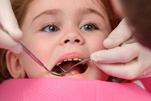 o dentista examina os dentes de leite da menina, o tratamento dos dentes de leite, o dentista segura um espelho. foto