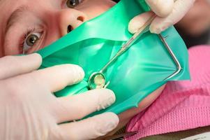 o dentista trata o dente da criança usando um dique de borracha. foto