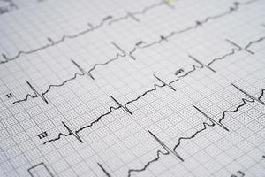 ECG do eletrocardiograma com coração vermelho, onda cardíaca, ataque cardíaco, relatório do cardiograma. foto