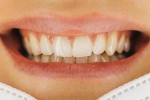 close-up de uma boca sorridente de dentes de uma mulher
