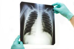 mão de homem segurando uma radiografia de pulmões isolada no fundo branco. médico usando máscara e luvas olhando para radiografia de tórax foto