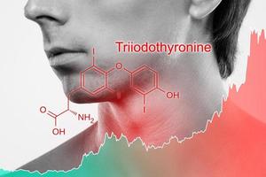 pescoço masculino e gráfico de aumento do hormônio triiodotironina foto