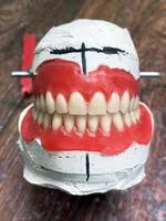 próteses dentárias totais removíveis em modelos de gesso. prótese total natural confeccionada com materiais de qualidade em modelo de gesso. foco seletivo, close-up. vista frontal dos maxilares superior e inferior foto