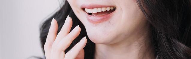 conceito de estomatologia, retrato parcial de menina com fortes dentes brancos, olhando para a câmera e sorrindo, dedos perto do rosto. closeup de jovem no dentista, estúdio, dentro de casa foto