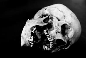 crânio humano de fibra de vidro no lado faltando dentes em um fundo preto foto