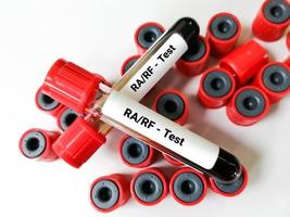 amostra de sangue rf ou fator reumatóide ou ra ou teste de artrite reumatóide, diagnóstico de doença de artrite reumatóide. foto