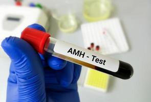 tubo de amostra de sangue para teste de hormônio amh ou anti-mulleriano, avaliação da função ovariana e fertilidade na mulher foto