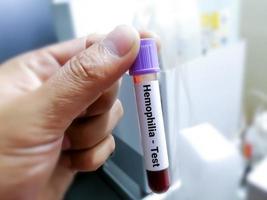 amostra de sangue para teste de distúrbio hemorrágico hereditário, hemofilia. foto