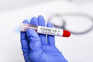 amostra de sangue infectada por coronavírus covid-19 no tubo de amostra na mão de cientista de coronavírus com pano de proteção contra riscos biológicos, pesquisa de vacina contra coronavírus covid-19 foto