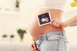 close-up da mulher grávida segurando a ultra-sonografia na barriga dela foto