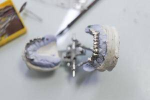 prótese dentária, dentaduras, trabalho de próteses. mãos protéticas enquanto trabalhava na dentadura, dentes postiços, um estudo e uma mesa com utensílios odontológicos foto