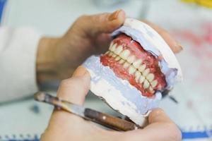 dentista segurando prótese dentária de cerâmica foto