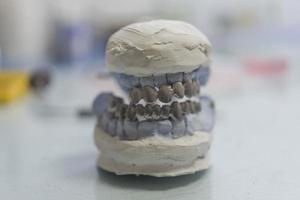 prótese dentária, dentaduras, trabalho de próteses. mãos protéticas enquanto trabalhava na dentadura, dentes postiços, um estudo e uma mesa com utensílios odontológicos foto