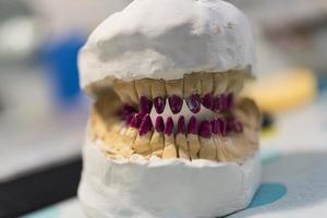 prótese dentária, dentaduras, trabalho de próteses. mãos protéticas enquanto trabalhava na dentadura, dentes postiços, um estudo e uma mesa com utensílios odontológicos foto