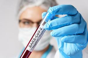 médica está segurando uma amostra de sangue do sars-cov-2 foto