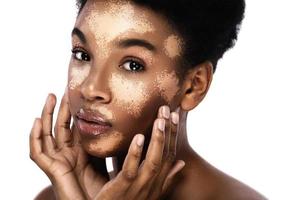 linda mulher negra com doença de pele vitiligo