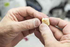 técnico dentário trabalhando em molde impresso em 3D para implantes dentários foto