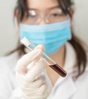 cientista analisando segurando amostra de sangue em tubo de ensaio foto