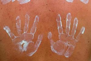 forma de creme protetor solar para mãos brancas na pele foto