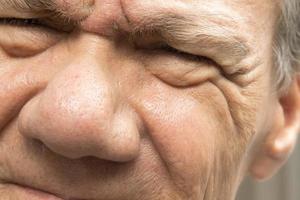 close-up de um homem mais velho apertando os olhos com os dois olhos