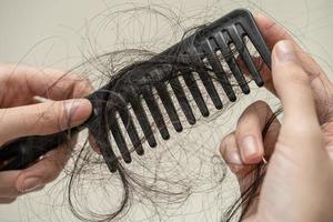 mulher asiática tem problema com perda de cabelo comprido anexar a escova de pente. foto