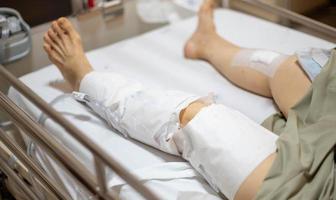 a velha senhora paciente mostra suas cicatrizes cirurgia de ferida cirúrgica da perna quebrada na cama na enfermaria do hospital de enfermagem.