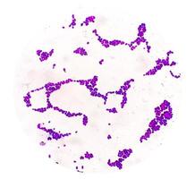 colônia de candida spp sob visão microscópica. Candida albicans. infecção fúngica. foto