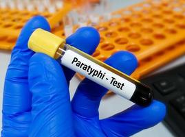 paratyphi teste, para diagnosticar paratifóide infecção causou de a bactéria salmonela paratyphi foto