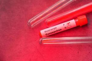close up de um tubo de amostra de sangue foto