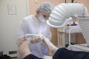 tratamento do unha do pé fungo dentro a hospital. foto